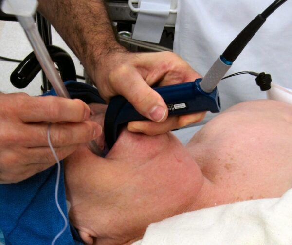 Critical Care Airway